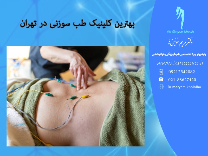 بهترین کلینیک طب سوزنی در تهران