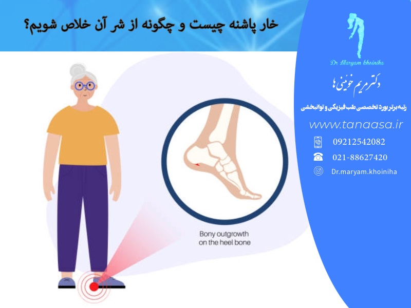 خار پاشنه چیست و چگونه از شر آن خلاص شویم؟ - دکتر مریم خوئینیها