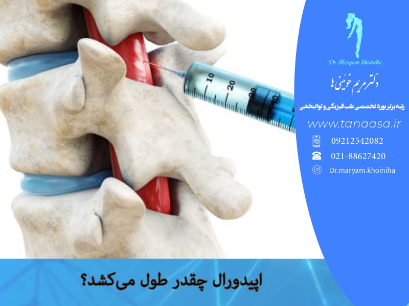 اپیدورال چقدر طول می‌کشد؟